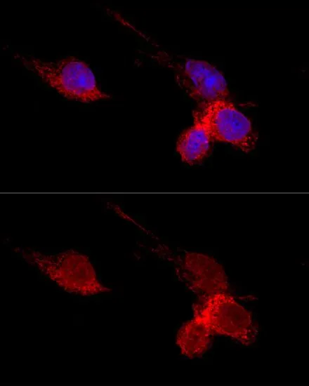 ICC/IF analysis of HeLa cells using GTX32847 RPL36 antibody. Blue : DAPI Dilution : 1:200