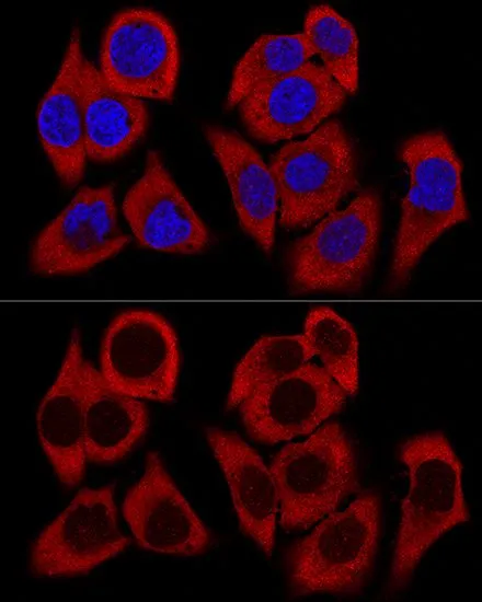 ICC/IF analysis of HeLa cells using GTX32847 RPL36 antibody. Blue : DAPI Dilution : 1:200