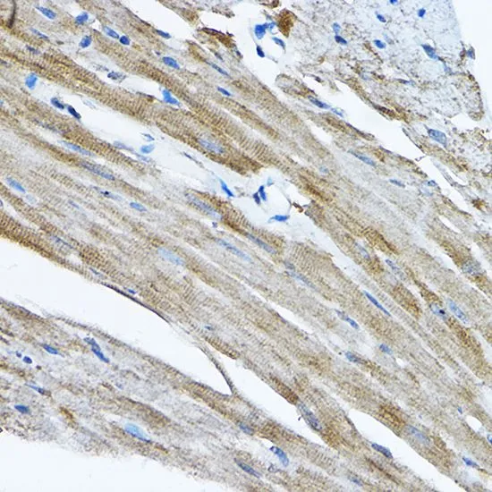 IHC-P analysis of mouse heart tissue using GTX32847 RPL36 antibody. Dilution : 1:200