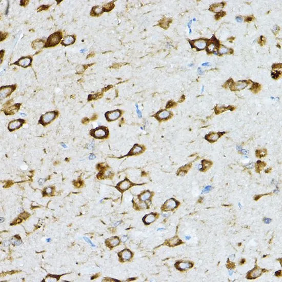 IHC-P analysis of rat brain tissue using GTX32847 RPL36 antibody. Dilution : 1:200