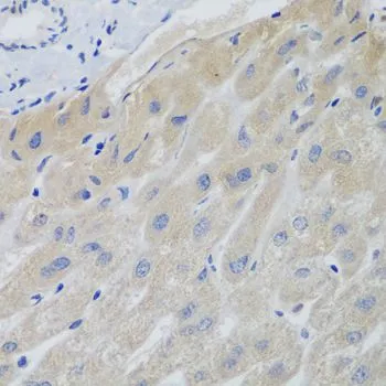 IHC-P analysis of human liver tissue using GTX32862 Securin antibody. Dilution : 1:100