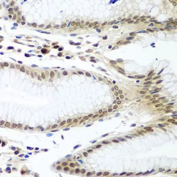 IHC-P analysis of human stomach tissue using GTX32862 Securin antibody. Dilution : 1:100