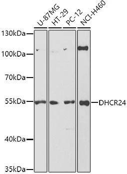 WB analysis of various sample lysates using GTX32863 Seladin 1 antibody. Dilution : 1:1000 Loading : 25microg per lane WB analysis of various sample lysates using GTX32863 Seladin 1 antibody. Dilution : 1:1000 Loading : 25microg per lane