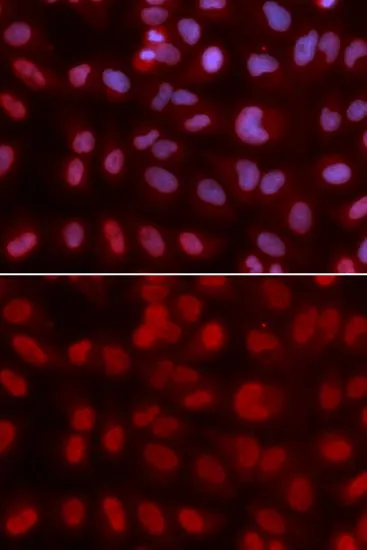 ICC/IF analysis of U2OS cells using GTX32874 SIN3A antibody. Blue : DAPI