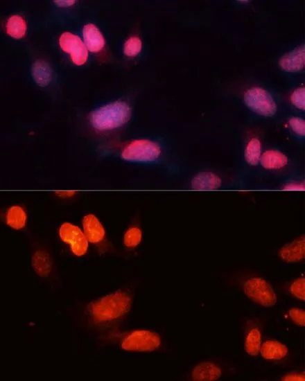 ICC/IF analysis of NIH/3T3 cells using GTX32875 SIRT1 antibody. Blue : DAPI Dilution : 1:100