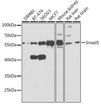 WB analysis of various sample lysates using GTX32881 SMAD5 antibody. Dilution : 1:1000 Loading : 25microg per lane WB analysis of various sample lysates using GTX32881 SMAD5 antibody. Dilution : 1:1000 Loading : 25microg per lane