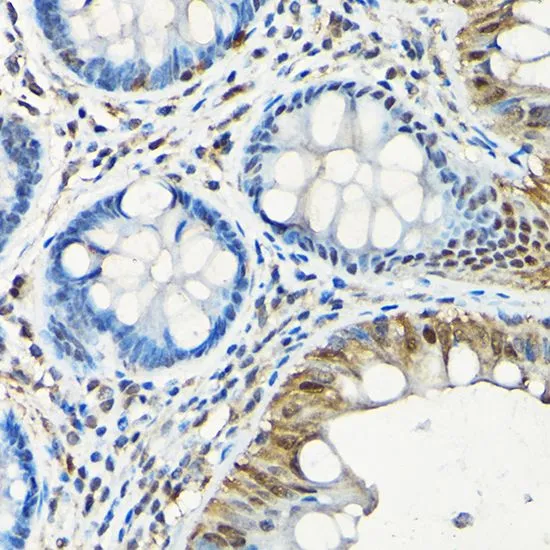IHC-P analysis of human colon tissue using GTX32881 SMAD5 antibody. Dilution : 1:150