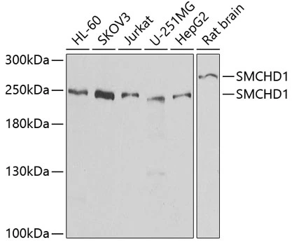 WB analysis of various sample lysates using GTX32883 SMCHD1 antibody. Dilution : 1:1000 Loading : 25microg per lane WB analysis of various sample lysates using GTX32883 SMCHD1 antibody. Dilution : 1:1000 Loading : 25microg per lane