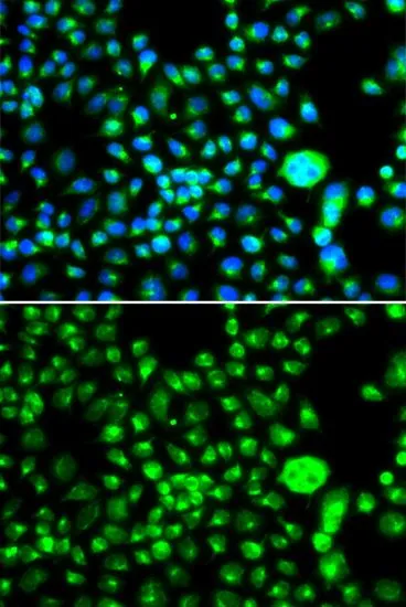 ICC/IF analysis of MCF7 cells using GTX32883 SMCHD1 antibody. Blue : DAPI