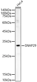 WB analysis of HeLa whole cell lysate using GTX32887 SNAP29 antibody. Dilution : 1:700 Loading : 25 microg WB analysis of HeLa whole cell lysate using GTX32887 SNAP29 antibody. Dilution : 1:700 Loading : 25 microg
