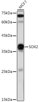 WB analysis of MCF7 cell lysate using GTX32891 SOX2 antibody. Dilution : 1:1000 Loading : 25microg per lane