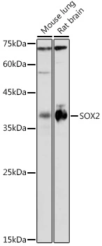 WB analysis of various sample lysates using GTX32891 SOX2 antibody. Dilution : 1:1000 Loading : 25microg per lane