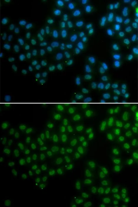 ICC/IF analysis of A549 cells using GTX32891 SOX2 antibody.