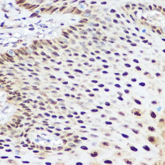 IHC-P analysis of human esophageal tissue using GTX32891 SOX2 antibody. Dilution : 1:100