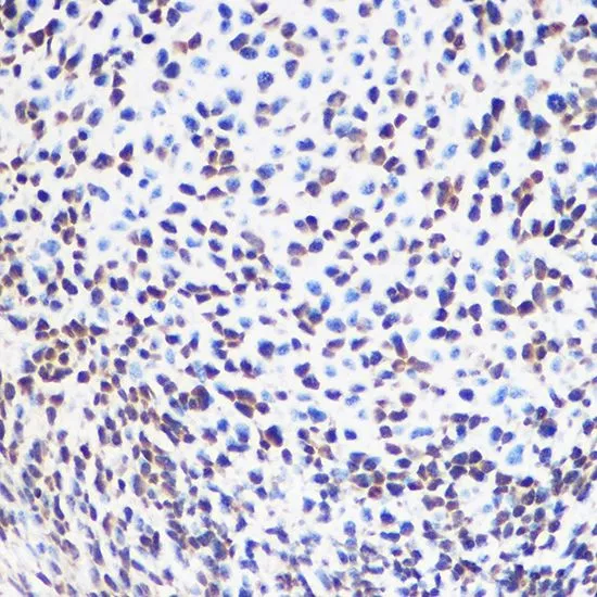 IHC-P analysis of mouse embryos tissue using GTX32891 SOX2 antibody. Dilution : 1:100