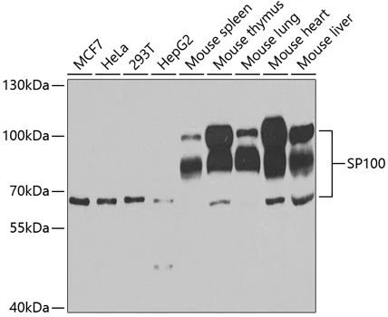 WB analysis of various sample lysates using GTX32892 SP100 antibody. The signal was developed with ECL plus-Enhanced. Dilution : 1:1000 Loading : 25microg per lane WB analysis of various sample lysates using GTX32892 SP100 antibody. The signal was developed with ECL plus-Enhanced. Dilution : 1:1000 Loading : 25microg per lane