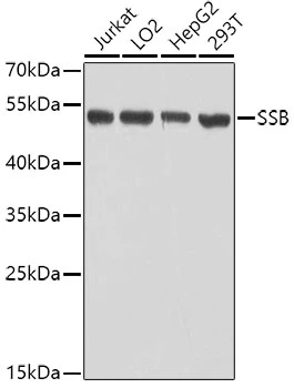 WB analysis of various sample lysates using GTX32896 SSB antibody. Dilution : 1:1000 Loading : 25microg per lane