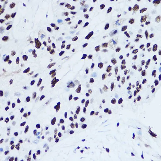 ICC/IF analysis of U2OS cells using GTX32896 SSB antibody. Blue : DAPI Dilution : 1:100