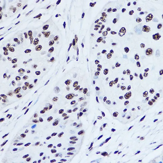 IHC-P analysis of human stomach tissue using GTX32896 SSB antibody. Dilution : 1:100