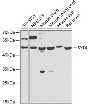 WB analysis of various sample lysates using GTX32906 SYT4 antibody. Dilution : 1:1000 Loading : 25microg per lane WB analysis of various sample lysates using GTX32906 SYT4 antibody. Dilution : 1:1000 Loading : 25microg per lane