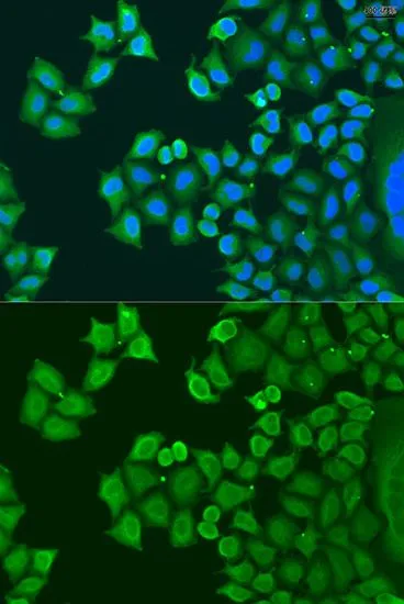 ICC/IF analysis of U2OS cells using GTX32906 SYT4 antibody. Blue : DAPI Dilution : 1:100