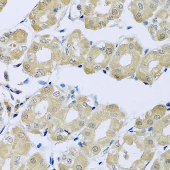 IHC-P analysis of human stomach tissue using GTX32906 SYT4 antibody. Dilution : 1:100