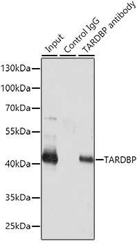 IP analysis of SW620 cell lysate using GTX32912 TDP43 antibody. Antibody amount : 3microg / 200microg lysate Dilution : 1:500 IP analysis of SW620 cell lysate using GTX32912 TDP43 antibody. Antibody amount : 3microg / 200microg lysate Dilution : 1:500