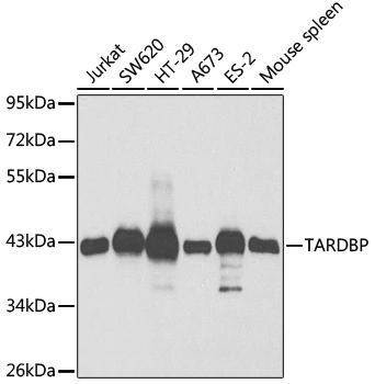 WB analysis of various sample lysates using GTX32912 TDP43 antibody. Dilution : 1:1000 Loading : 25microg per lane
