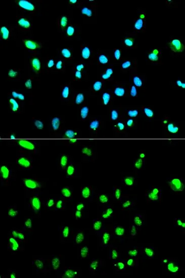 ICC/IF analysis of HeLa cells using GTX32912 TDP43 antibody. Blue : DAPI