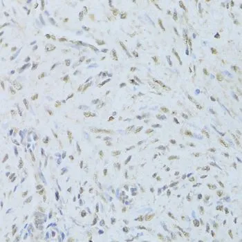 IHC-P analysis of human endometrium tissue using GTX32912 TDP43 antibody. Dilution : 1:200