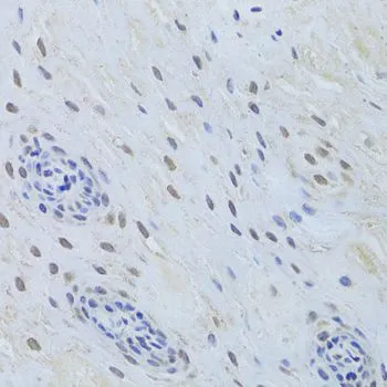 IHC-P analysis of human esophagus tissue using GTX32912 TDP43 antibody. Dilution : 1:200