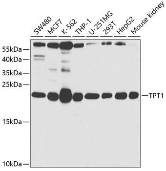 WB analysis of various sample lysates using GTX32916 TCTP antibody. Dilution : 1:1000 Loading : 25microg per lane WB analysis of various sample lysates using GTX32916 TCTP antibody. Dilution : 1:1000 Loading : 25microg per lane