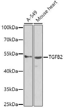 WB analysis of various samples using GTX32920 TGF beta 2 antibody. Dilution : 1:1000 Loading : 25ug per lane