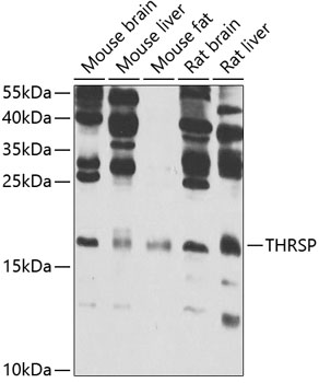 WB analysis of various samples using GTX32922 THRSP antibody.The signal was developed with ECL plus-Enhanced. Dilution : 1:1000 Loading : 25ug per lane