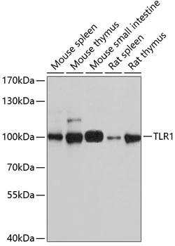 WB analysis of various sample lysates using GTX32924 TLR1 antibody. Dilution : 1:1000 Loading : 25microg per lane WB analysis of various sample lysates using GTX32924 TLR1 antibody. Dilution : 1:1000 Loading : 25microg per lane