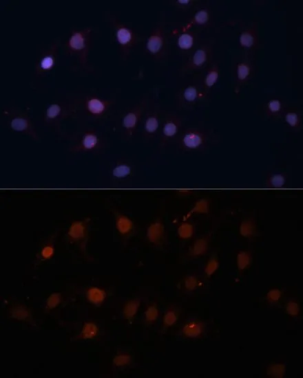 ICC/IF analysis of C6 cells using GTX32929 TOM70 antibody. Blue : DAPI Dilution : 1:100 ICC/IF analysis of C6 cells using GTX32929 TOM70 antibody. Blue : DAPI Dilution : 1:100