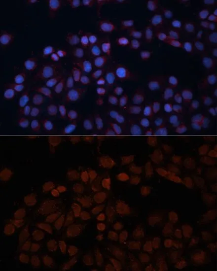 ICC/IF analysis of HeLa cells using GTX32929 TOM70 antibody. Blue : DAPI Dilution : 1:100