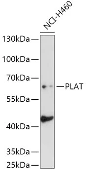 WB analysis of NCI-H460 cell lysate using GTX32930 tPA antibody. Dilution : 1:1000 Loading : 25microg per lane