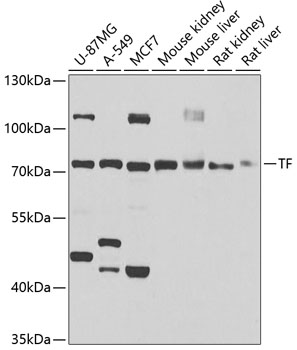 WB analysis of various samples using GTX32933 Transferrin antibody. Dilution : 1:1000 Loading : 25ug per lane