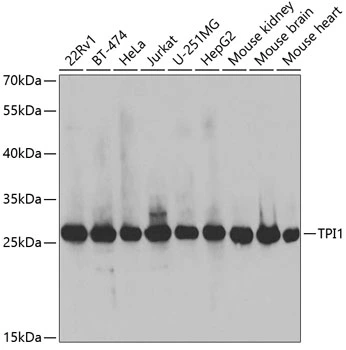 WB analysis of various sample lysates using GTX32936 Triosephosphate isomerase antibody. Dilution : 1:1000 Loading : 25microg per lane WB analysis of various sample lysates using GTX32936 Triosephosphate isomerase antibody. Dilution : 1:1000 Loading : 25microg per lane