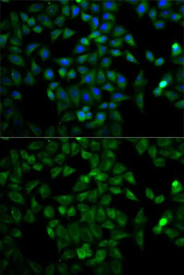 ICC/IF analysis of HeLa cells using GTX32936 Triosephosphate isomerase antibody. Blue : DAPI