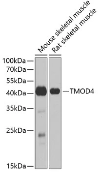 WB analysis of various sample lysates using GTX32937 Tropomodulin 4 antibody. Dilution : 1:1000 Loading : 25microg per lane WB analysis of various sample lysates using GTX32937 Tropomodulin 4 antibody. Dilution : 1:1000 Loading : 25microg per lane