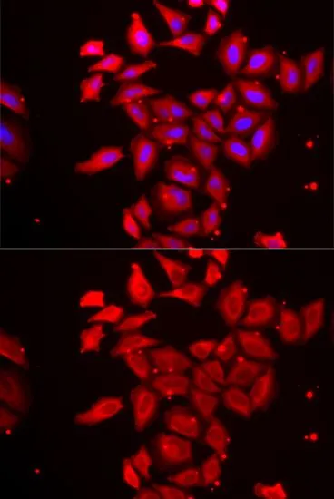 ICC/IF analysis of U2OS cells using GTX32937 Tropomodulin 4 antibody. Blue : DAPI