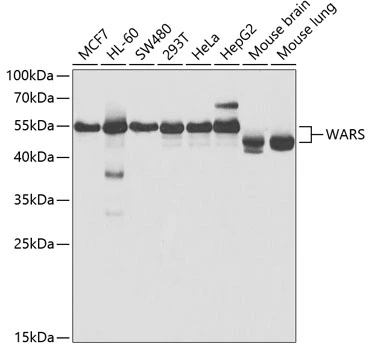 WB analysis of various sample lysates using GTX32939 Tryptophanyl tRNA synthetase antibody. Dilution : 1:1000 Loading : 25microg per lane WB analysis of various sample lysates using GTX32939 Tryptophanyl tRNA synthetase antibody. Dilution : 1:1000 Loading : 25microg per lane