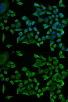 ICC/IF analysis of U2OS cells using GTX32939 Tryptophanyl tRNA synthetase antibody. Blue : DAPI
