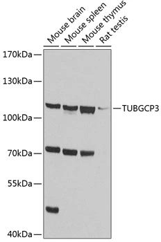 WB analysis of various sample lysates using GTX32942 TUBGCP3 antibody. Dilution : 1:1000 Loading : 25microg per lane WB analysis of various sample lysates using GTX32942 TUBGCP3 antibody. Dilution : 1:1000 Loading : 25microg per lane