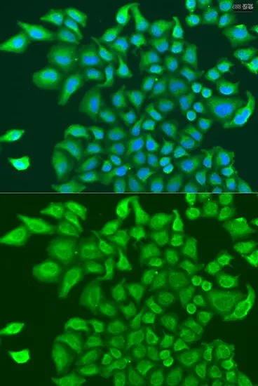 ICC/IF analysis of U2OS cells using GTX32942 TUBGCP3 antibody. Blue : DAPI Dilution : 1:100