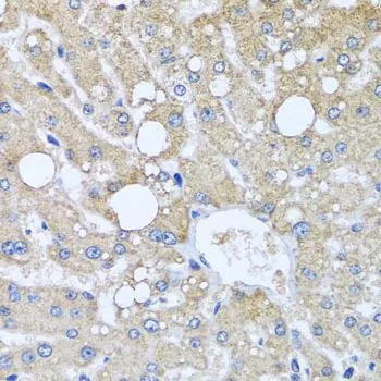 IHC-P analysis of human liver damage tissue using GTX32942 TUBGCP3 antibody. Dilution : 1:100
