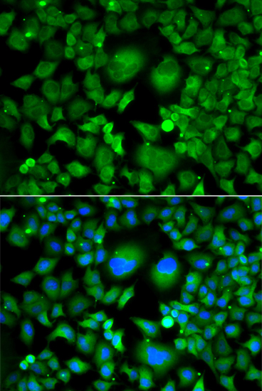 ICC/IF analysis of A549 cell using GTX32944 UBE2H antibody. Blue : DAPI