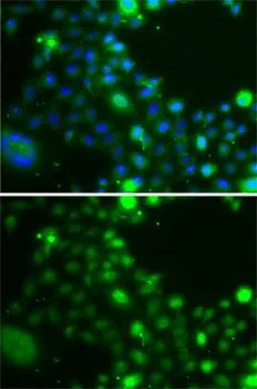 ICC/IF analysis of A549 cells using GTX32945 UBE2Z antibody. Blue : DAPI